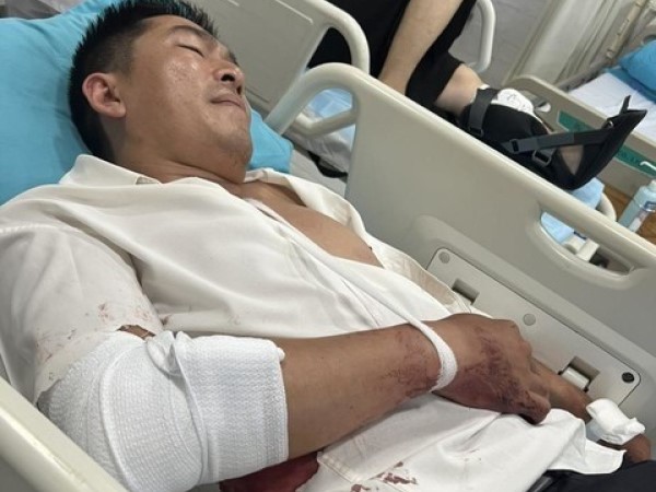 Một thẩm phán bị trộm đột nhập vào nhà chém trọng thương