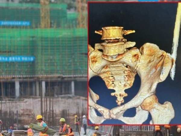 Thêm 1 vụ tai nạn lao động ở công trường xây dựng, nữ công nhân bị thanh sắt rơi trúng, đâm xuyên người