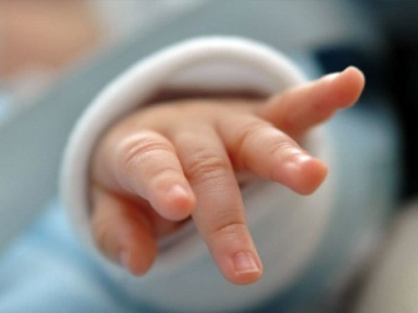 Em bé Hà Nội chào đời với hội chứng siêu nữ ít gặp