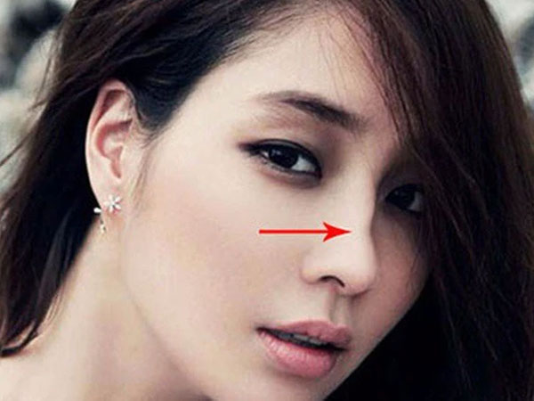 Nét tướng mặt đặc trưng của người xui xẻo, làm việc gì cũng khó thành công