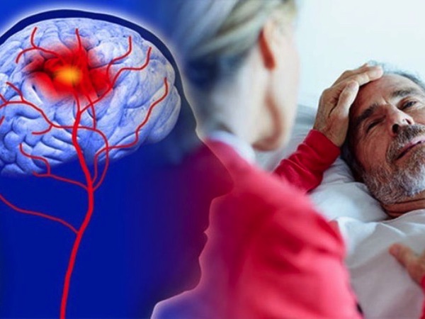 Người đàn ông 53 tuổi liệt nửa người, đột quỵ não giữa đêm: BS chỉ ra ngay 2 thói quen làm tăng nguy cơ