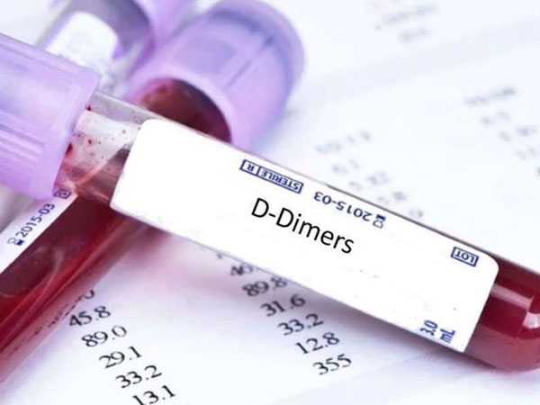 Bộ Y tế chính thức lên tiếng về thông tin 'xét nghiệm đông máu sau tiêm vắc xin AstraZeneca'