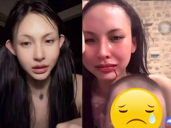 Lâm Minh muốn ôm con đi sau vụ bị đánh, vẫn bênh bạn trai Decao: 'Đứng giữa vợ và mẹ rất khó'