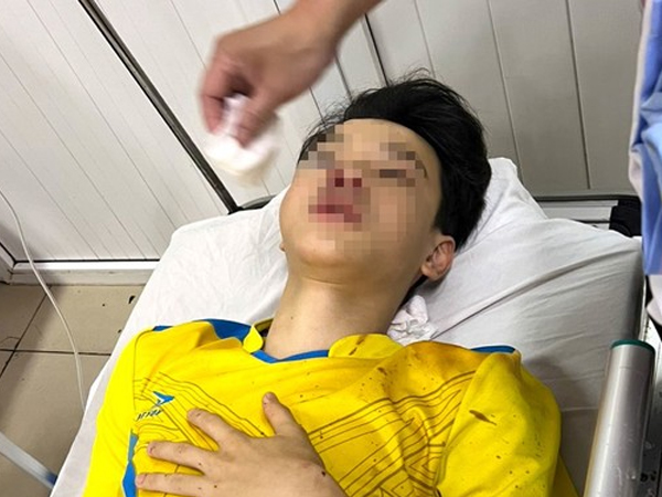Gặp tai nạn trên đường đi thi vào lớp 10, nam sinh phải bỏ thi