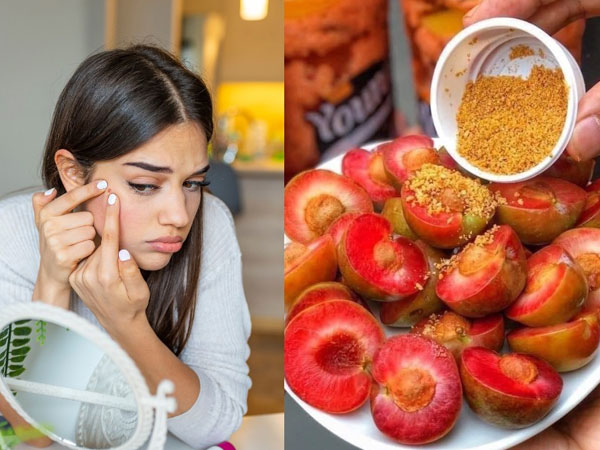 Vì sao nhiều người bị nổi mụn khi ăn mận, vải, mít,... xoài?
