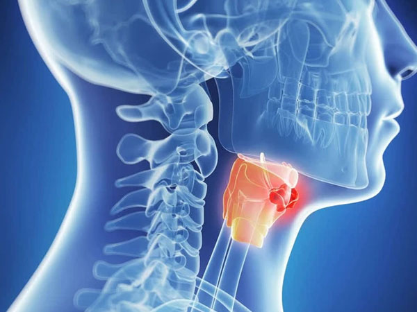 Khàn tiếng kéo dài 3 tháng, người đàn ông ở Hà Nội bất ngờ khi nhận kết quả chẩn đoán