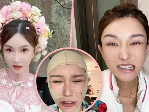 Bỏ ra gần 5 tỷ đồng phẫu thuật thẩm mỹ nhưng gặp biến chứng, KOL khiến hơn 2,2 triệu fan 'sốc' nặng