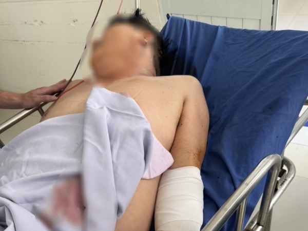 Cãi nhau với người đàn ông lạ mặt, tài xế bị chém trọng thương