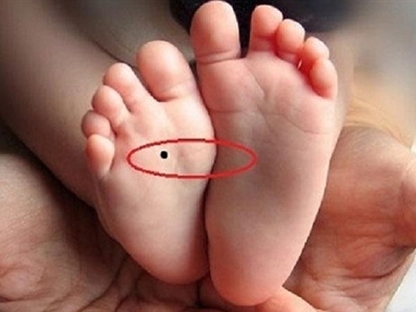 Có phải NỐT RUỒI Ở LÒNG BÀN CHÂN là phúc tướng, tiền tiêu khỏi nghĩ?