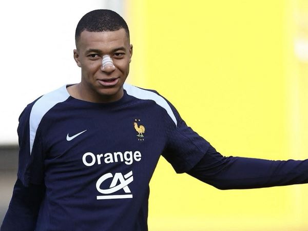 Real Madrid muốn Mbappe phẫu thuật mũi sớm, Pháp nói không