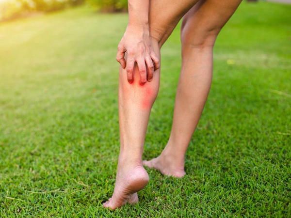 Cụ bà phải cắt cụt hai chân chỉ vì côn trùng đốt