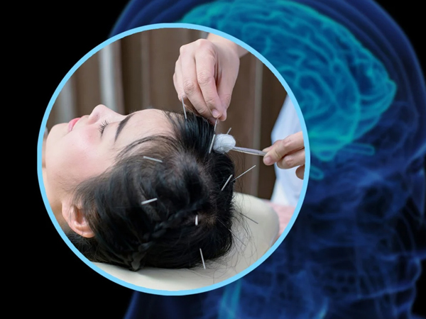 Bệnh viện gây tranh cãi khi tuyên bố: Dùng châm cứu để giúp người đến khám tăng được chỉ số IQ