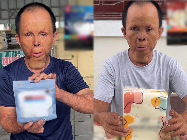 Chuyện cảm động về người cha bị biến dạng khuôn mặt vẫn kiên trì livestream bán hàng, nuôi 4 con ăn học