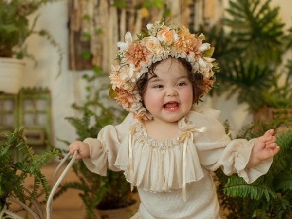 Từng mắc hội chứng lạ khi mới sinh, bé gái 1 tuổi ngày càng nổi tiếng trên MXH nhờ khuôn mặt đáng yêu như thiên thần