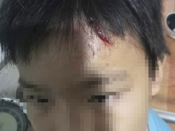 Lời kể của bé trai 10 tuổi nghi bị mẹ kế bạo hành ở Cà Mau