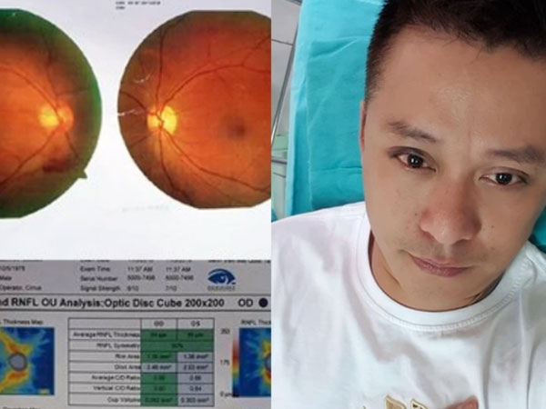 Sao nam từng gặp tai nạn nghiêm trọng, bị xuất huyết bên trong gây suy giảm thị lực