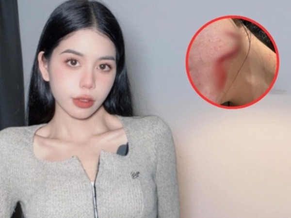 Đã có kết quả kiểm tra loạt thương tích của Hằng Du Mục