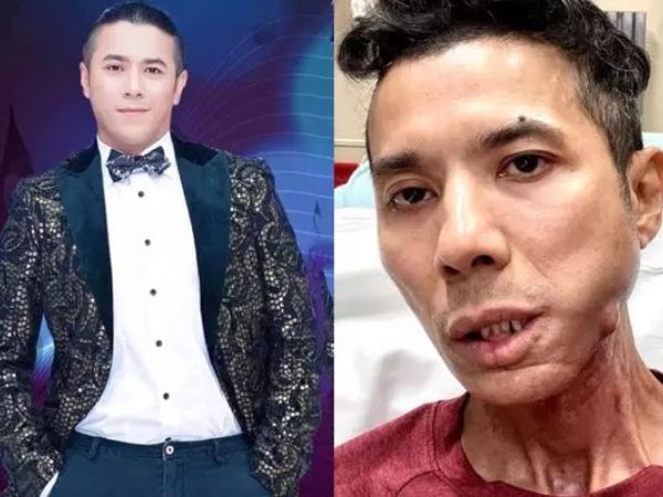 Ảnh bìa bài viết 951469
