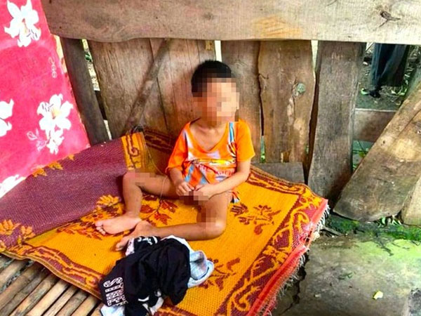 Bé 5 tuổi có nhiều vết thương bị đưa ra ở riêng trong lán tạm