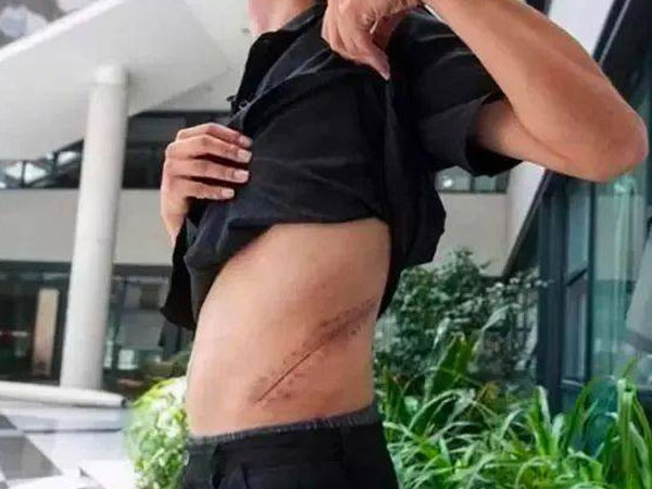 Nam thanh niên bị dụ dỗ ra nước ngoài bán thận với giá 900 triệu-1,2 tỉ đồng