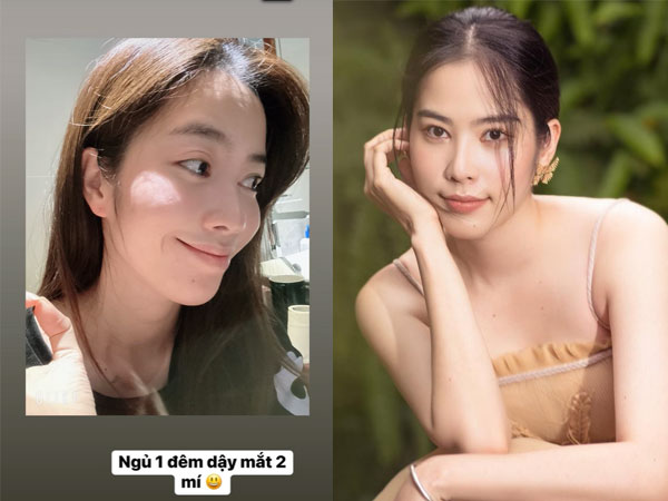 Ngoại hình đáng lo ngại của Nam Em