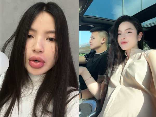 Không nhận ra vợ Quang Hải khi 'tái' thẩm mỹ gương mặt, tình trạng thế nào mà không dám gặp chồng con?