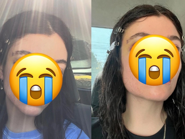 Nữ ca sĩ bất ngờ xóa sạch Instagram, đăng ảnh mắt tím bầm gây hoang mang