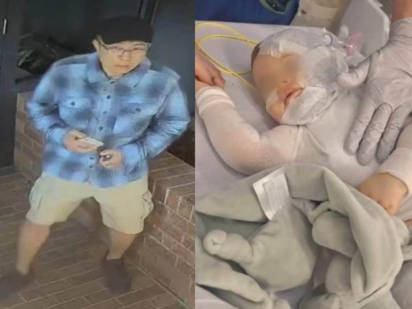 Vụ việc gây phẫn nộ: Gã trai lạ bỗng làm thân rồi tạt cà phê nóng khiến bé 9 tháng tuổi bỏng nặng toàn thân, nguy kịch