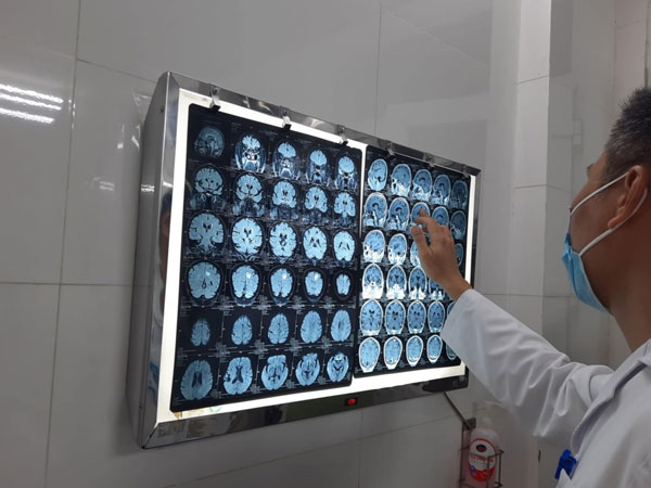Tưởng mắc u não, người phụ nữ Thái Bình khóc hết nước mắt: Kết quả phát hiện nguyên nhân bất ngờ