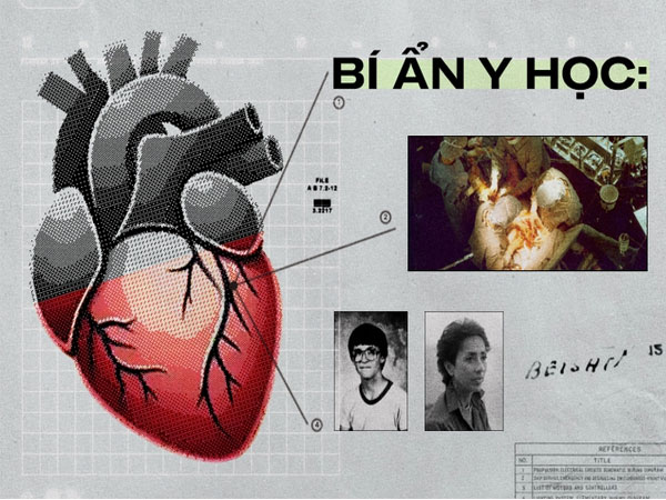 Bí ẩn y học: Trái tim được hiến tặng mách bảo chủ nhân mới tìm về nhà chủ nhân cũ, dù danh tính hai bên đã bị giấu kín