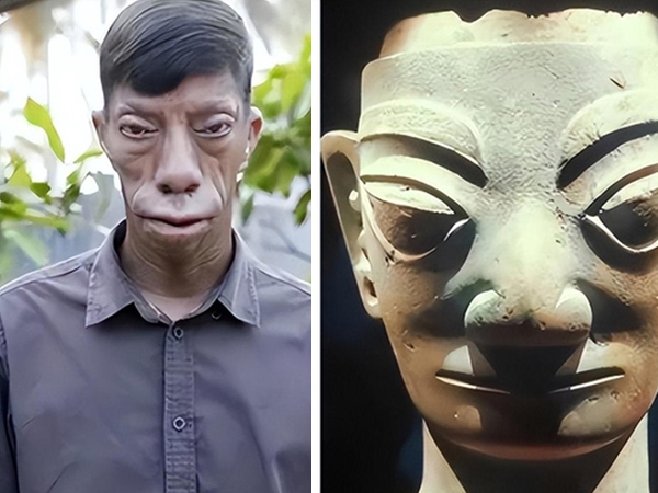 Người 'mặt ngựa' như bị nguyền rủa và câu chuyện đổi đời ngoạn mục