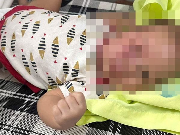Công an vào cuộc vụ cháu bé 3 tháng tuổi bị đánh bầm tím mặt