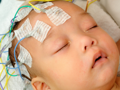 Xôn xao thông tin 'bé 3 tuổi đột quỵ, ra đi trong tích tắc': Bác sĩ nêu 3 tình huống có thể đã xảy ra