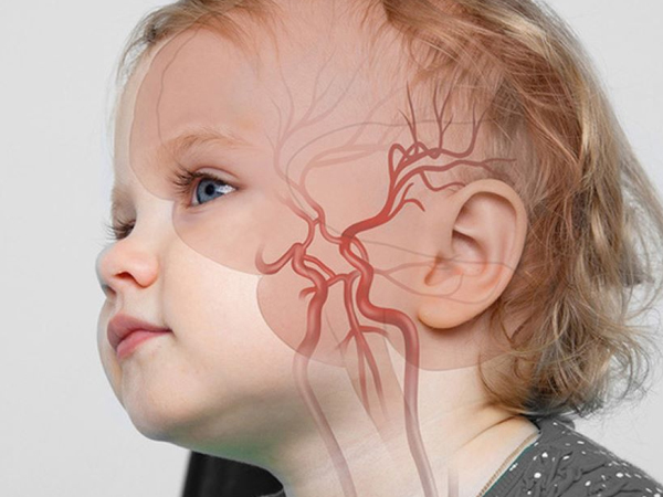 'Chia sẻ xót xa của người mẹ chứng kiến con 3 tuổi ra đi vì đột quỵ': Có 2 dấu hiệu nhưng không nhận ra