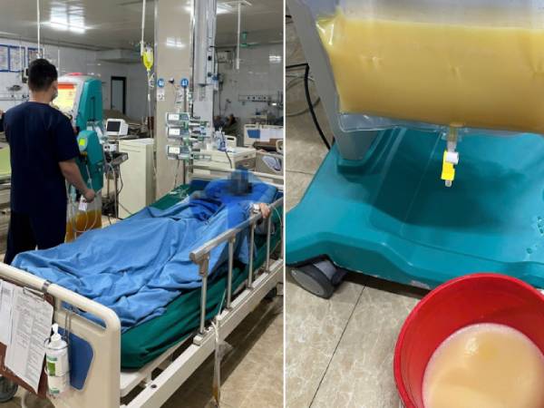 Bác sĩ không thể tin nguyên nhân khiến người đàn ông cấp cứu trong đêm