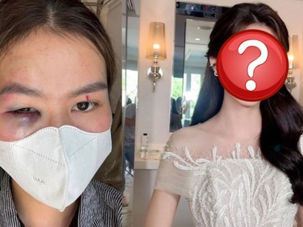 Vụ đi trang điểm đám cưới, thợ makeup tố bị em gái cô dâu 'tương tác' bầm tím mắt: Hai bên nói gì?