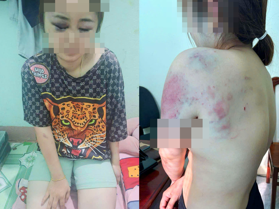 Người đàn ông đánh vợ sắp cưới suốt 13 tiếng: Hé lộ nguồn cơn
