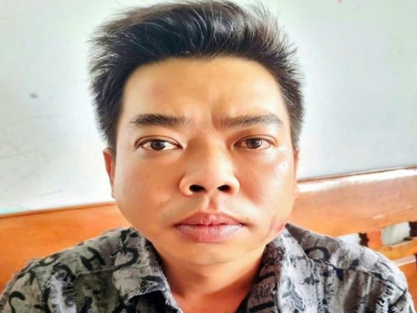 Chém lìa tay bạn nhậu vì lời bài hát 'Đất phương Nam'