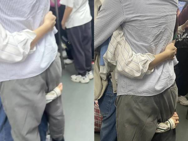 Bức ảnh chụp một người với 3 cánh tay gây sốt: Nhiều tiền để làm gì nếu không biết cảm giác này?