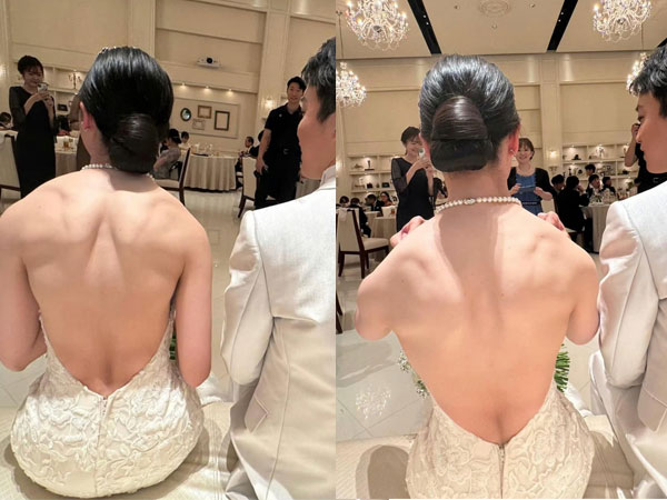Bức ảnh khoe lưng trần của cô dâu khiến tất cả phải hốt hoảng