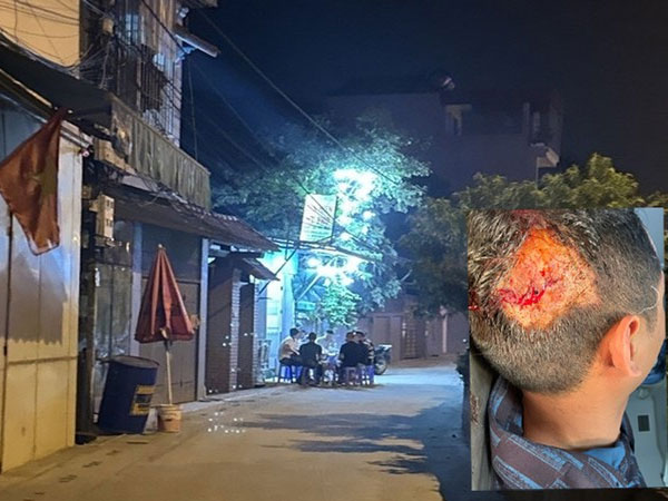 Hà Nội: Bị đánh chấn động não trong đêm mà không biết vì sao, cũng không biết ai đánh