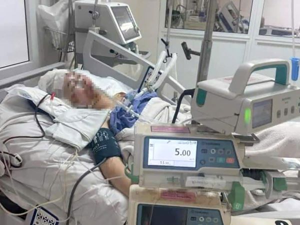 Va phải chó thả rông trên đường, hai chị em ruột gặp tai nạn nghiêm trọng
