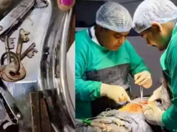 Cứu sống thanh niên 22 tuổi nuốt vào bụng cả dao, chìa khóa và bấm móng tay