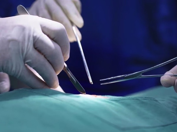Cô gái 23 tuổi bức xúc vì bị bác sĩ tự ý cắt bỏ ruột thừa