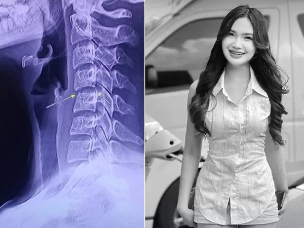 Lời khai của nhân viên massage 'bẻ cổ' cho nữ ca sĩ Thái Lan