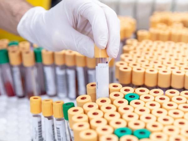 Australia thất lạc hơn 300 ống chứa virus nguy hiểm chết người