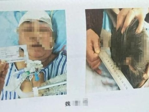 Thương tâm: Chứng kiến mẹ gặp tai nạn, con gái sốc đến mức liên tục hét 'Con phải cứu mẹ' suốt 5 ngày rồi qua đời