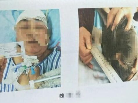 Thương tâm: Chứng kiến mẹ gặp tai nạn, con gái sốc đến mức liên tục hét 'Con phải cứu mẹ' suốt 5 ngày rồi qua đời