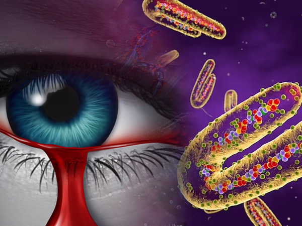 WHO cảnh báo về loại virus mới gây chảy máu mắt ở Tanzania khiến 8 người tử vong
