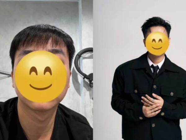 Ngay giáp Tết, 1 sao nam Vbiz đi làm đẹp, kết quả thế nào mà khiến cả showbiz 'sốc ngang'?